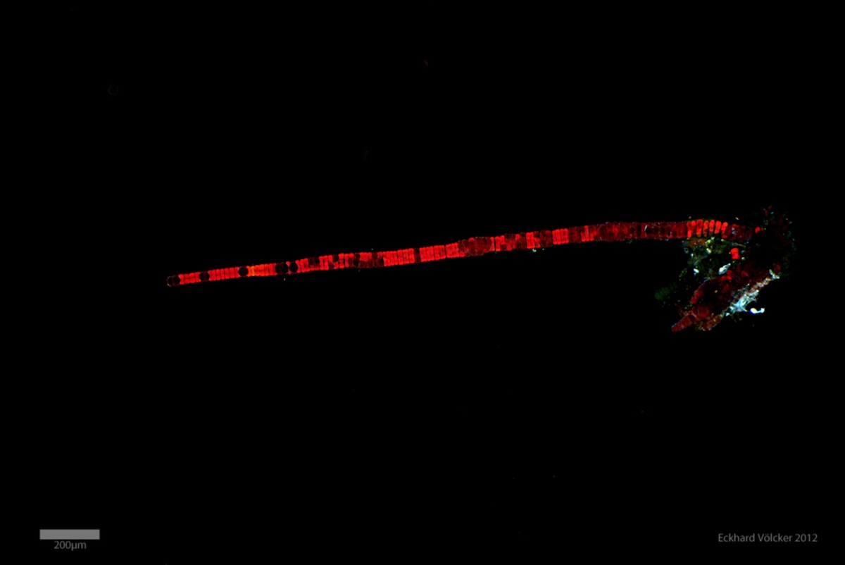 Loading Image